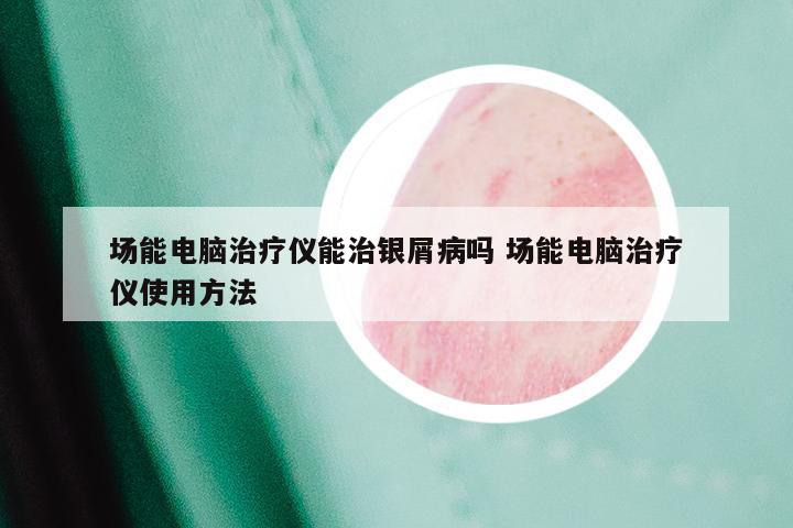 场能电脑治疗仪能治银屑病吗 场能电脑治疗仪使用方法