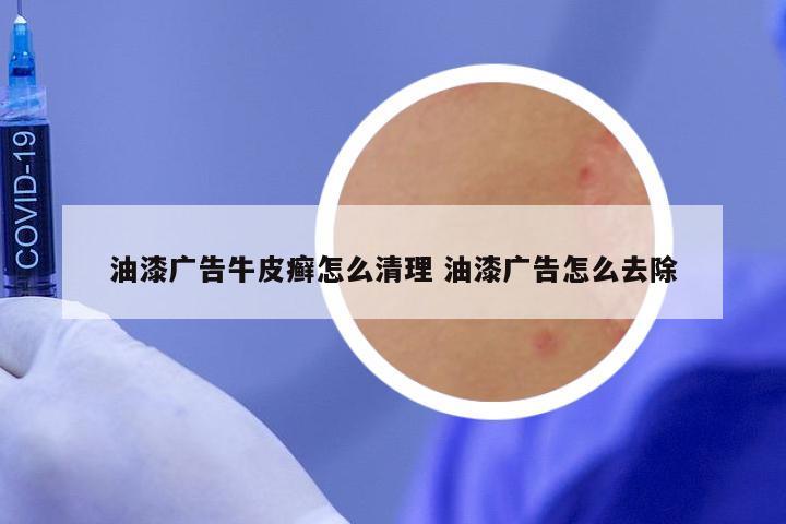 油漆广告牛皮癣怎么清理 油漆广告怎么去除