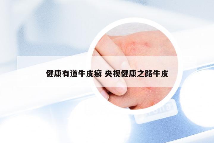 健康有道牛皮癣 央视健康之路牛皮