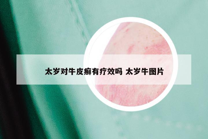 太岁对牛皮癣有疗效吗 太岁牛图片