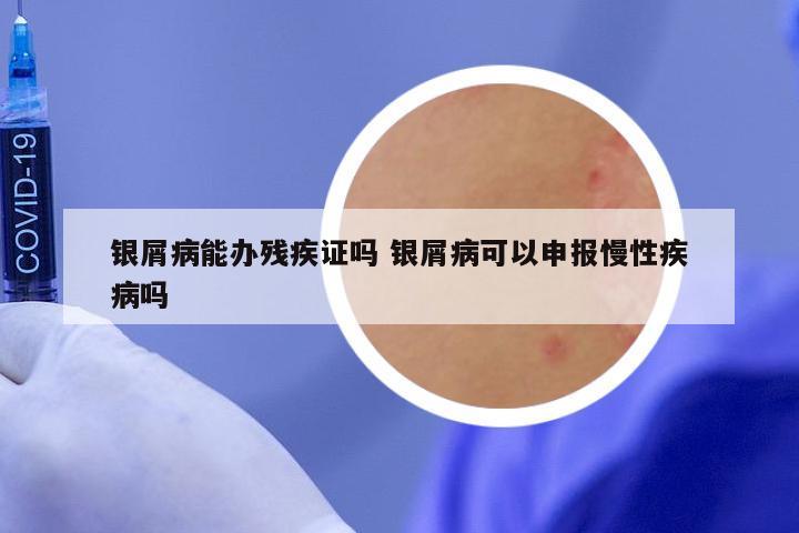 银屑病能办残疾证吗 银屑病可以申报慢性疾病吗