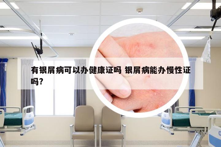 有银屑病可以办健康证吗 银屑病能办慢性证吗?