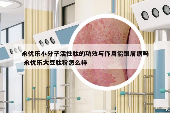 永优乐小分子活性肽的功效与作用能银屑病吗 永优乐大豆肽粉怎么样