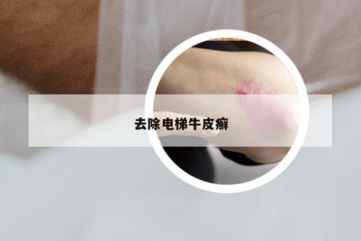 去除电梯牛皮癣