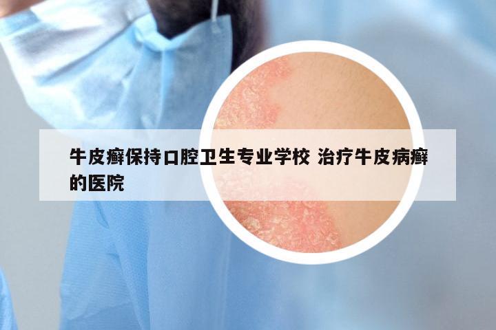 牛皮癣保持口腔卫生专业学校 治疗牛皮病癣的医院