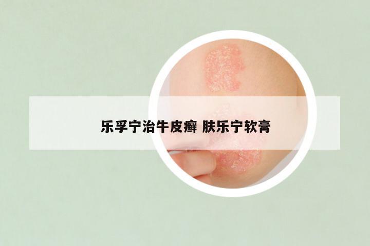 乐孚宁治牛皮癣 肤乐宁软膏