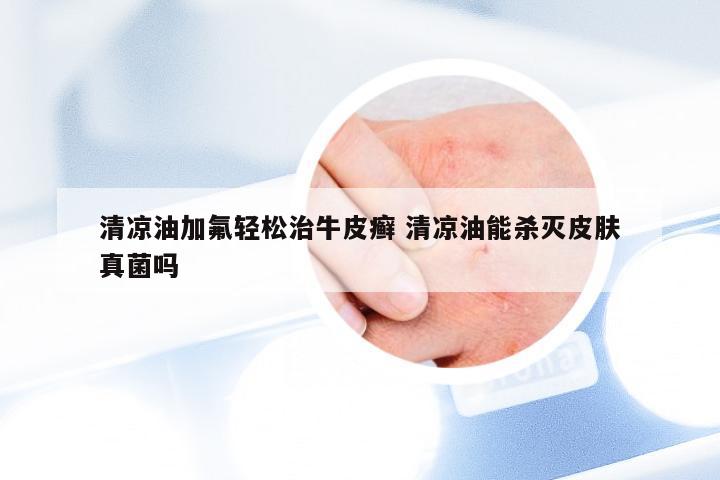 清凉油加氟轻松治牛皮癣 清凉油能杀灭皮肤真菌吗
