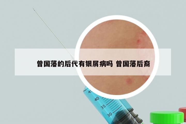 曾国藩的后代有银屑病吗 曾国藩后裔