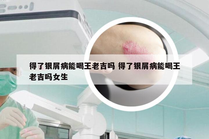 得了银屑病能喝王老吉吗 得了银屑病能喝王老吉吗女生
