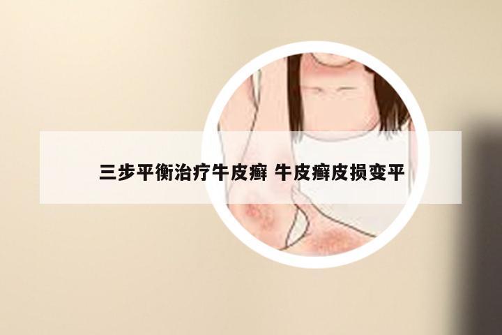 三步平衡治疗牛皮癣 牛皮癣皮损变平