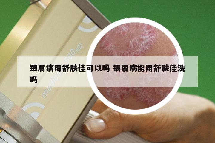 银屑病用舒肤佳可以吗 银屑病能用舒肤佳洗吗