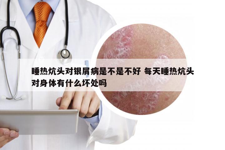 睡热炕头对银屑病是不是不好 每天睡热炕头对身体有什么坏处吗