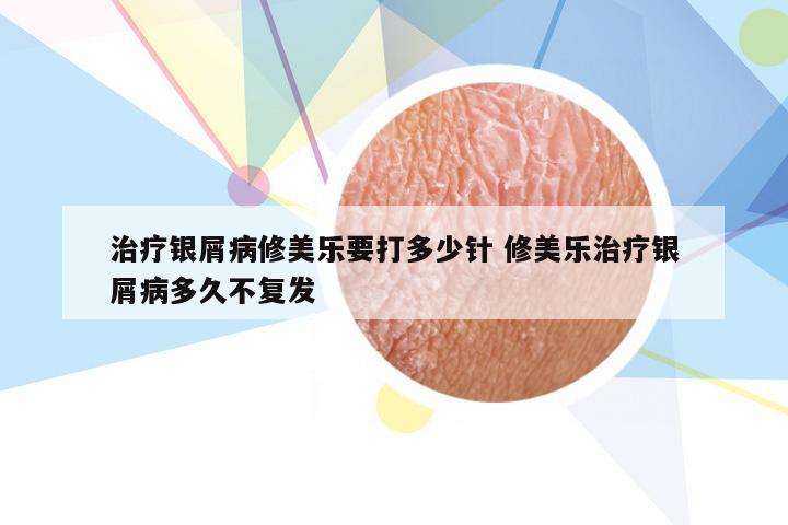 治疗银屑病修美乐要打多少针 修美乐治疗银屑病多久不复发