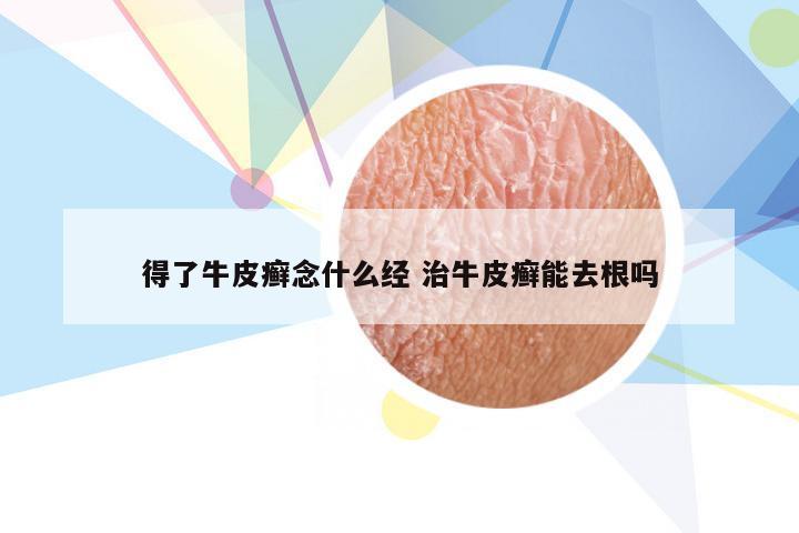 得了牛皮癣念什么经 治牛皮癣能去根吗