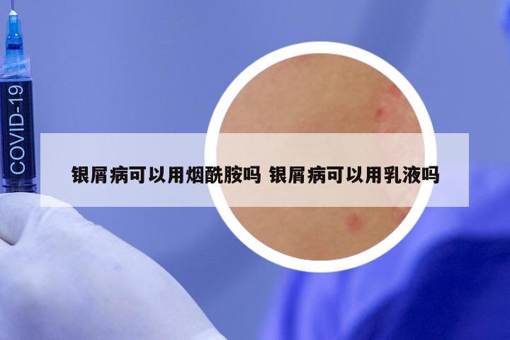 银屑病可以用烟酰胺吗 银屑病可以用乳液吗