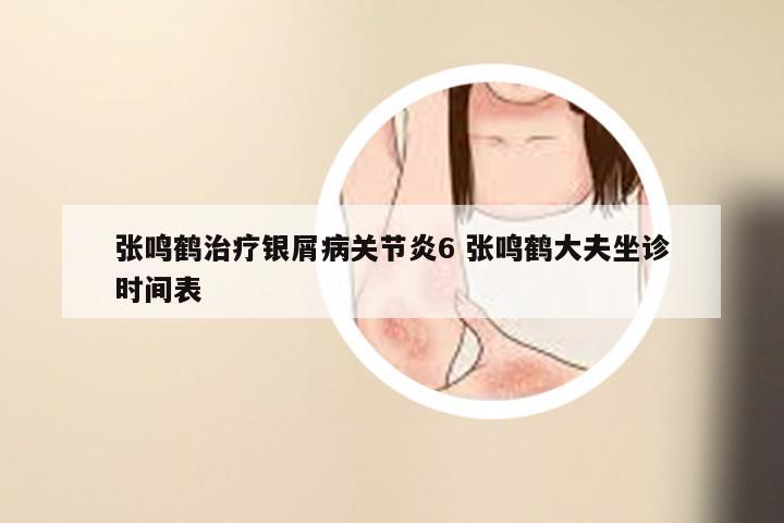张鸣鹤治疗银屑病关节炎6 张鸣鹤大夫坐诊时间表