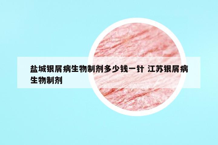 盐城银屑病生物制剂多少钱一针 江苏银屑病生物制剂