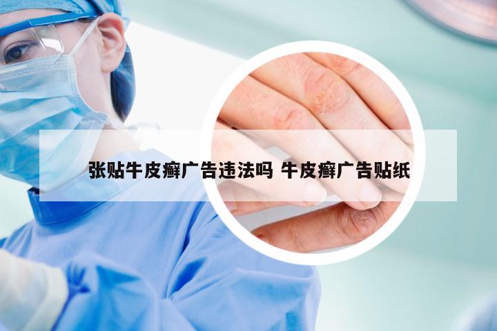 张贴牛皮癣广告违法吗 牛皮癣广告贴纸