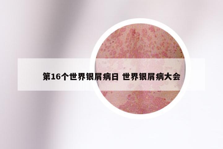 第16个世界银屑病日 世界银屑病大会