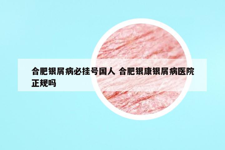 合肥银屑病必挂号国人 合肥银康银屑病医院正规吗