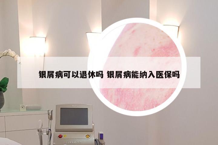 银屑病可以退休吗 银屑病能纳入医保吗