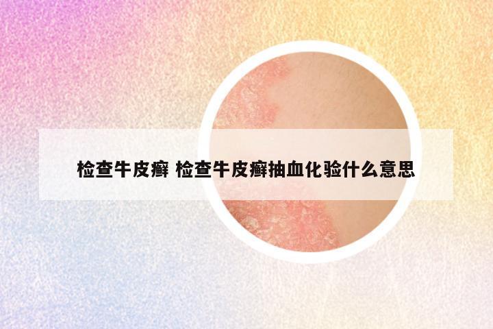 检查牛皮癣 检查牛皮癣抽血化验什么意思
